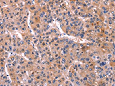 TNFRSF17 Antibody