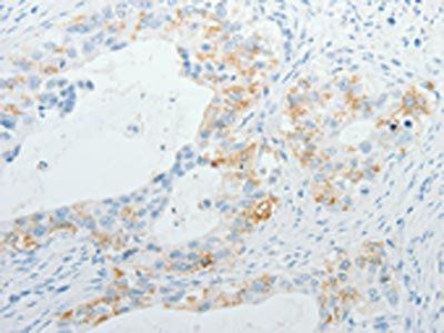 TNFRSF1B Antibody