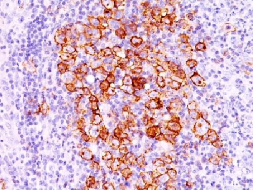 CD30 / TNFRSF8 (Hodgkin & Reed-Sternberg Cell Marker) Antibody