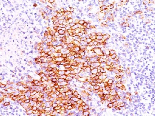 CD30 / TNFRSF8 (Hodgkin & Reed-Sternberg Cell Marker) Antibody