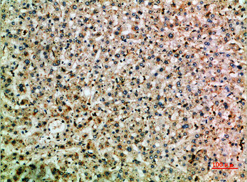 TNIP2 Antibody