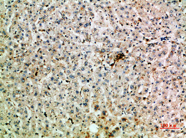 TNIP2 Antibody