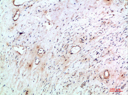 TNIP2 Antibody