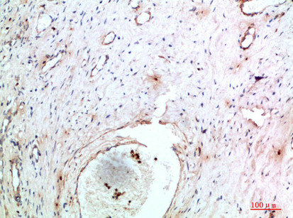 TNIP2 Antibody