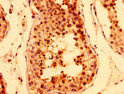 TNKS Antibody