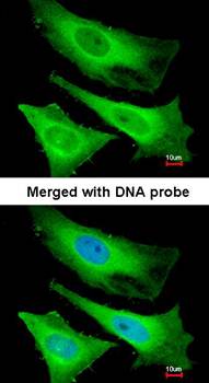 TNNI3K Rabbit Polyclonal Antibody