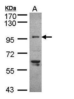 TNNI3K Rabbit Polyclonal Antibody