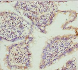 TNS3 Antibody