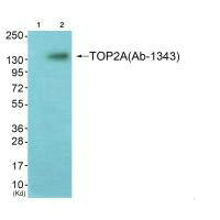 TOP2A Antibody