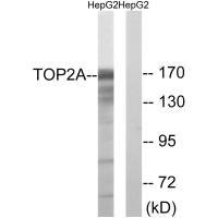 TOP2A Antibody