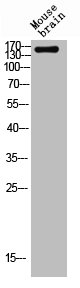 TOP2A Antibody