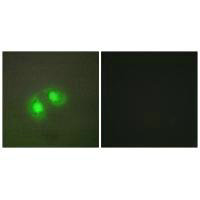 TOP2A Antibody