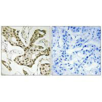 TOP2A Antibody