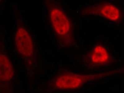 TP53 Antibody