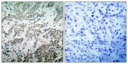 TP53 Antibody