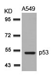 TP53 Antibody