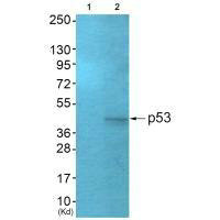 TP53 Antibody
