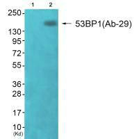 TP53BP1 Antibody
