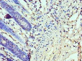 TP53BP1 Antibody