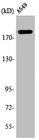 TP53BP1 Antibody