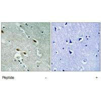 TP53BP1 Antibody