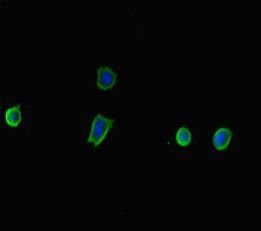 TP53INP2 Antibody