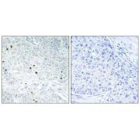 Tp53inp2 Antibody