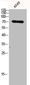 TP73 Antibody