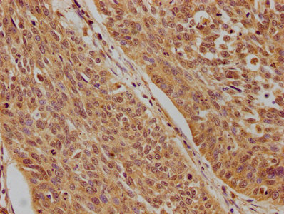 TP73 Antibody