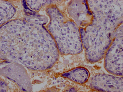 TPBG Antibody