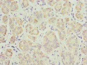 TPD52L1 Antibody