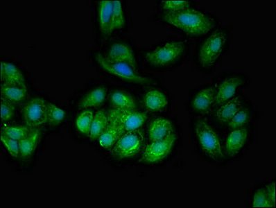 TPD52L2 Antibody