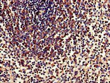 TPD52L2 Antibody