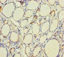 TPO Antibody