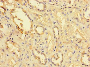 TPPP3 Antibody
