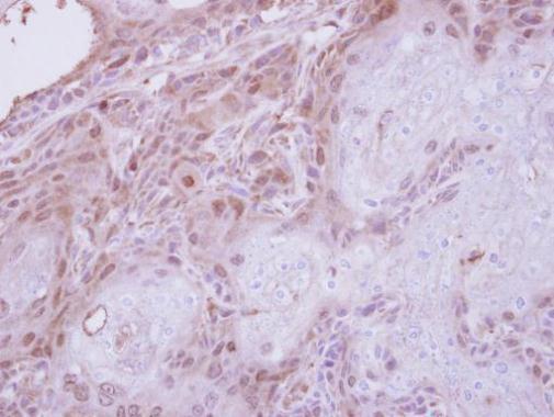 TPRKB Rabbit Polyclonal Antibody