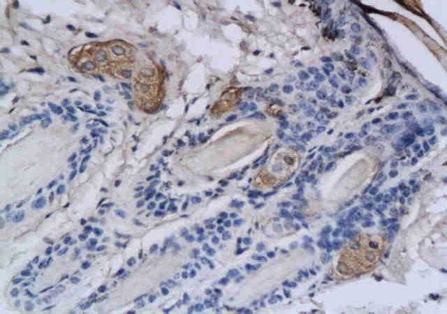 TPSB2 Rabbit Polyclonal Antibody