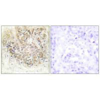 TPT1 Antibody