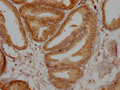 TPT1 Antibody