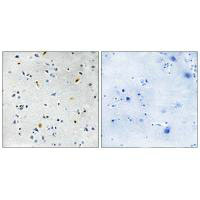 TPX2 Antibody