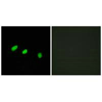 TRA2A Antibody