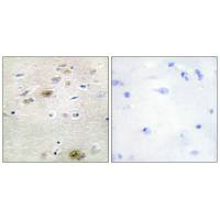 TRA2A Antibody