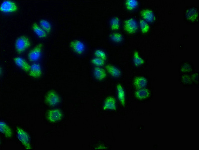 TRABD2B Antibody