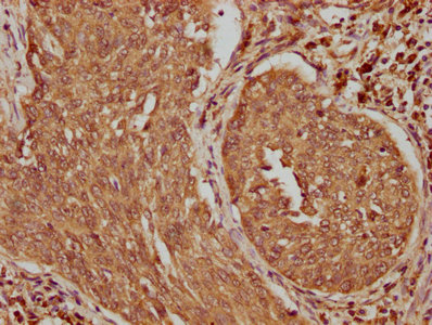 TRABD2B Antibody