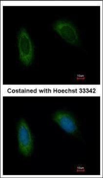 TRAM1 Rabbit Polyclonal Antibody