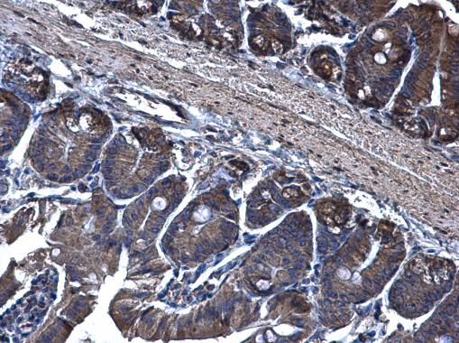 TRAM1 Rabbit Polyclonal Antibody