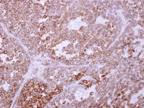 TRAM1 Rabbit Polyclonal Antibody