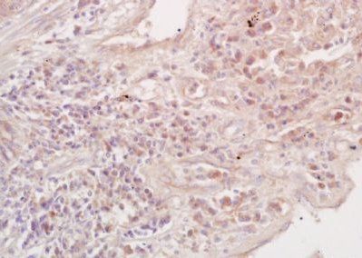 TFRC Rabbit Polyclonal Antibody