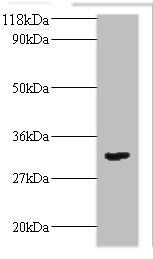 TGFB2 Antibody
