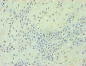 TGFB2 Antibody